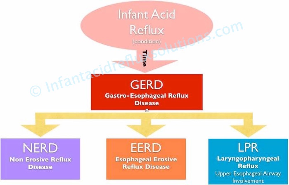 Acid reflux in newborns breastfeeding